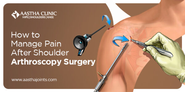 How to Manage Pain After Shoulder Arthroscopy Surgery