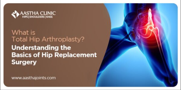 What is Total Hip Arthroplasty? Understanding the Basics of Hip Replacement Surgery