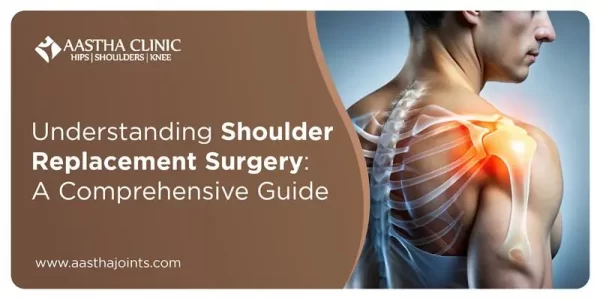 Understanding Shoulder Replacement Surgery: A Comprehensive Guide