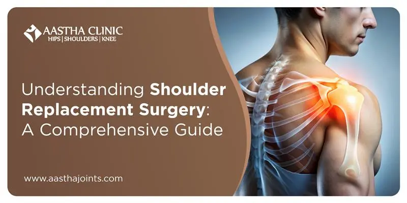 Illustration of a male shoulder highlighting anatomical details and a glowing joint to represent shoulder replacement surgery. The image features the text: 'Aastha Clinic - Hips | Shoulders | Knee,' and the headline 'Understanding Shoulder Replacement Surgery: A Comprehensive Guide' with the website URL www.aasthajoints.com. The design includes a brown and white theme, emphasizing orthopedic expertise and patient education.